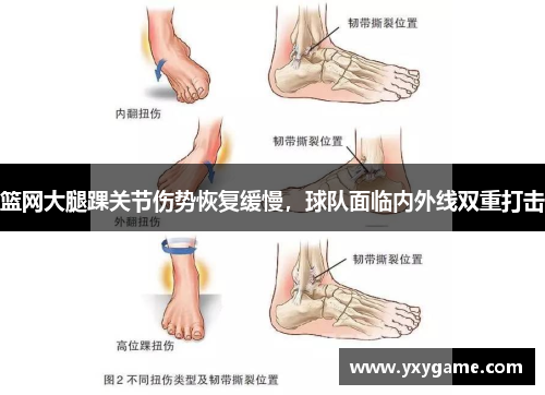 篮网大腿踝关节伤势恢复缓慢，球队面临内外线双重打击